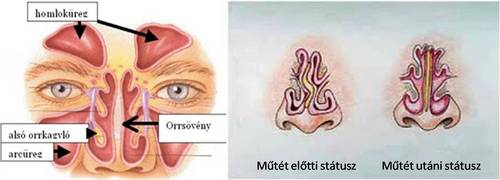 orrsovenyferdules